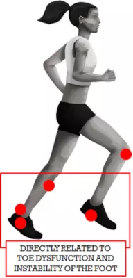 Bild: Joe Nimble/Laufverletzungen: Warum der Großzeh schuld ist, wenn das Schienbein schmerzt