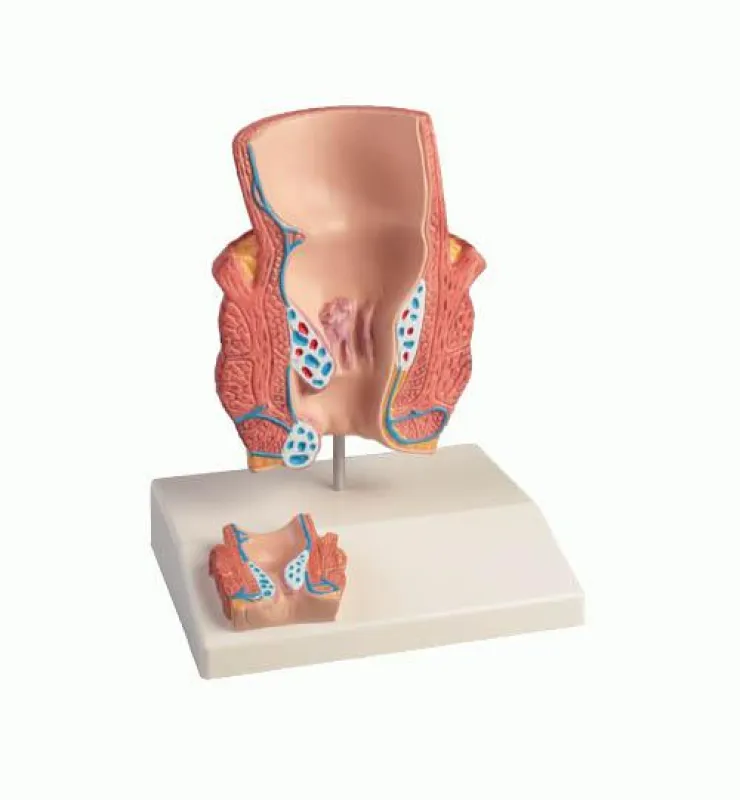 K227 Haemorrhoid Model