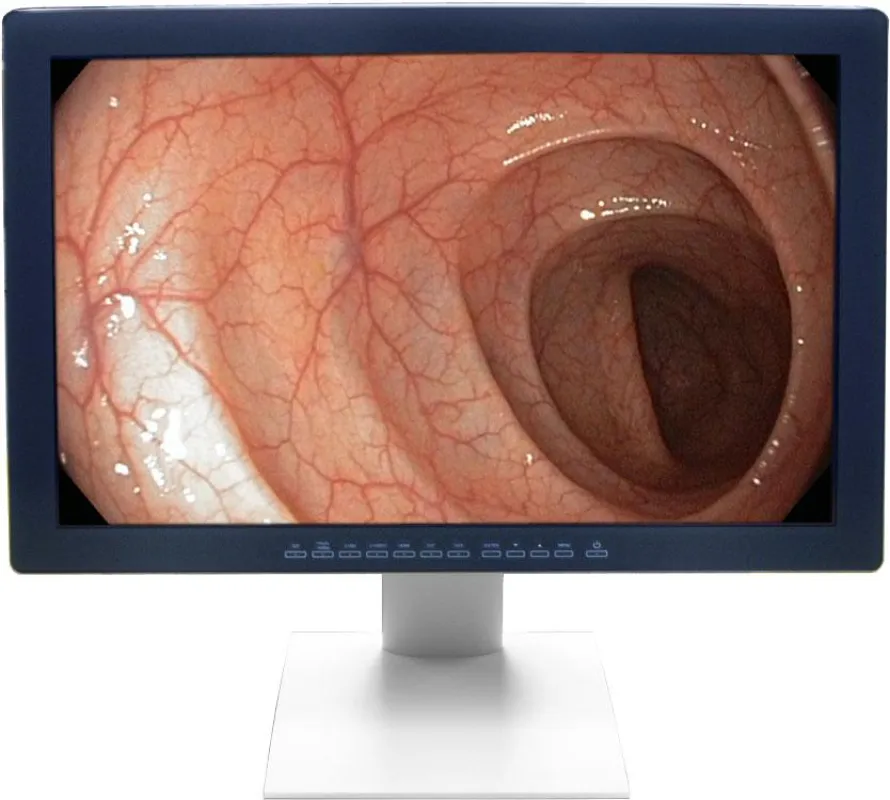 24Zoll Multinorm HD Display