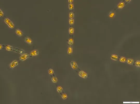 Bild: Nach 7000 Jahren ohne Licht und Luft im Ostseeschlamm: Forschende erwecken prähistorische Alge wieder zum Leben