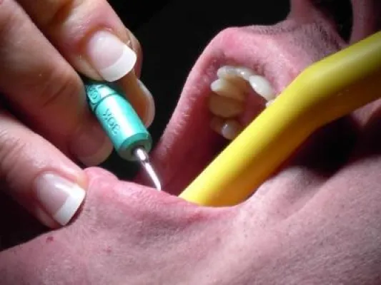 Bild: Wie viel Leistung bieten günstige Zahnzusatzversicherungen?