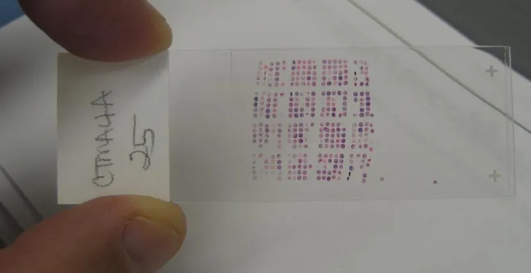 Bild: Vernetzte Computer beschleunigen Krebsforschung