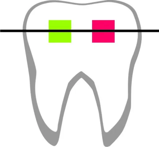 Bild: Weisheitszähne & Kieferorthopädie