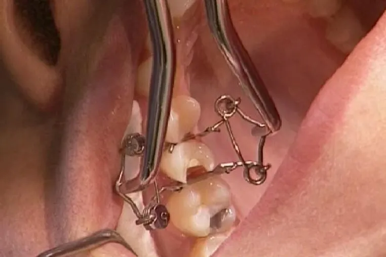Bild: „Großer Preis des Mittelstandes“: Endrunde für Dr. Walser Dental