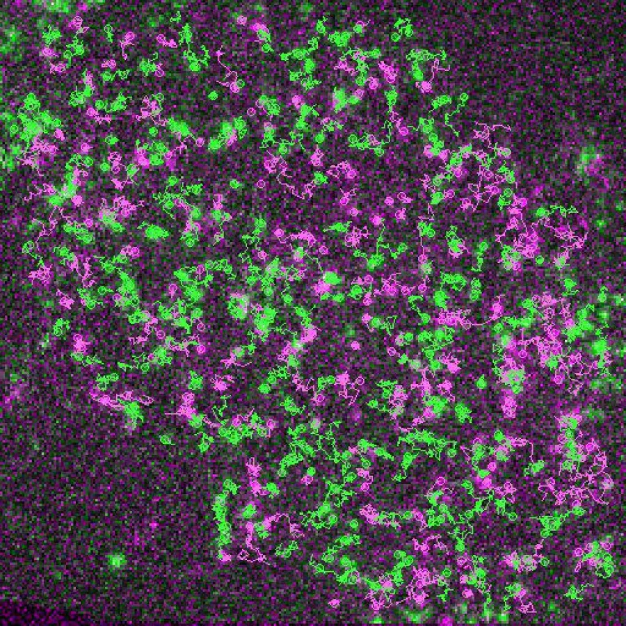 Simultaneous visualization and tracking of individual receptors (green) and G proteins (magenta) at the surface of a living cell. (Photo: Team Calebiro)
