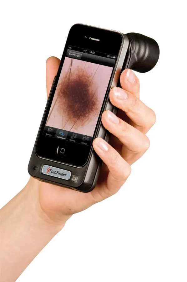 handyscope Schale und Ergebnisbild