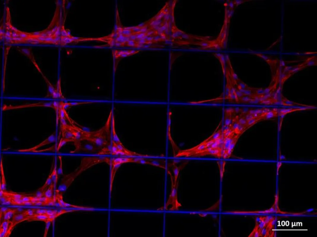 Vorläuferzellen des Stütz- und Bindegewebes (z.B. Knochen, Knorpel, Muskel, Bändern, Sehnen) auf einem Konstrukt aus biologisch abbaubarem Kunststoff. (Foto: Universitätsklinikum Würzburg)
