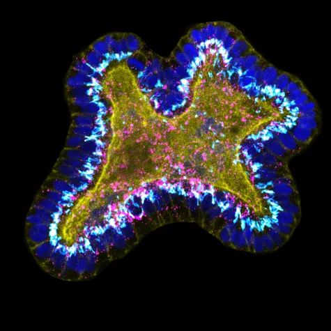 Mikroplastik in der Atmosphäre: Ausbreitung von Landflächen aus höher als vom Ozean Bild: Mikroplastik in der Atmosphäre: Ausbreitung von Landflächen aus höher als vom Ozean