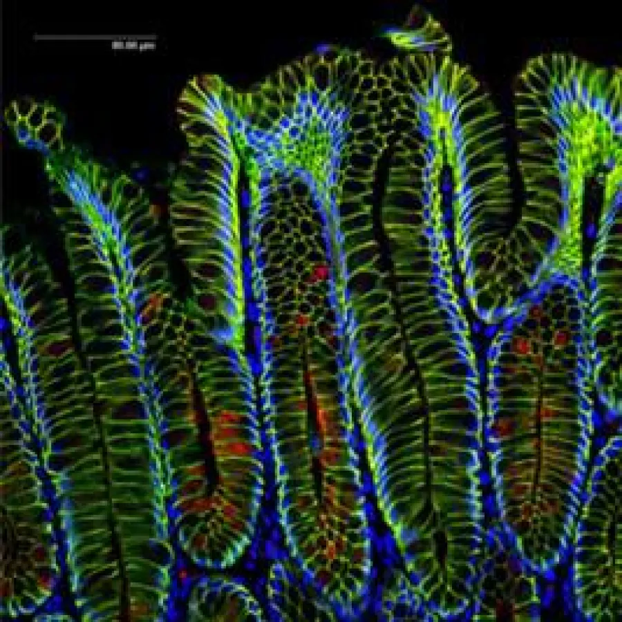 Magendrüsen nach Helicobacterinfektion im Querschnitt. Zellwände sind in grüner Farbe und Zellkerne in blauer Farbe dargestellt. (Bild: Max-Planck-Institut für Infektionsbiologie, Berlin.)