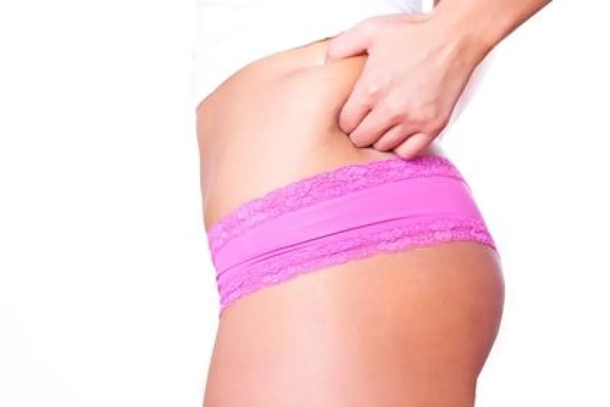 Mit dem JogStyle gegen den Winterspeck! © detailblick - Fotolia.com