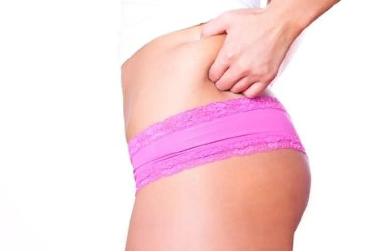 Mit dem JogStyle gegen den Winterspeck! © detailblick - Fotolia.com