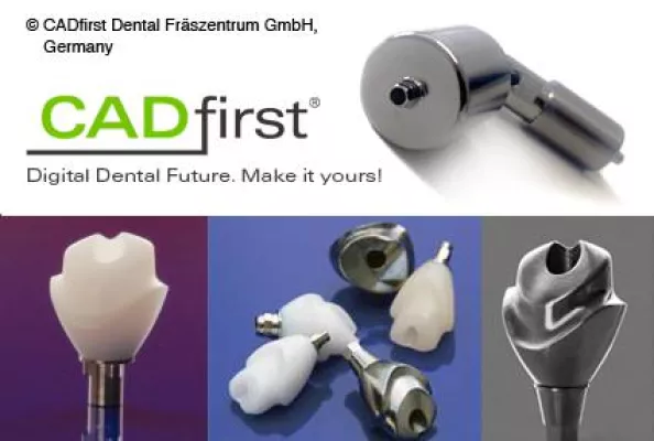 Bild: CADfirst Fräszentrum steigt in die Fertigung individueller Abutments ein.