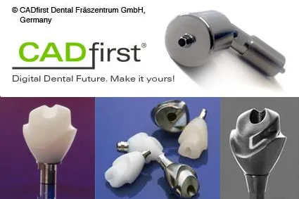 Bild: CADfirst Fräszentrum steigt in die Fertigung individueller Abutments ein.