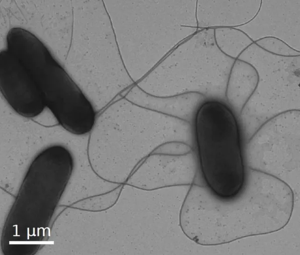 Bild: Researchers discover Achilles' heel of bacteria