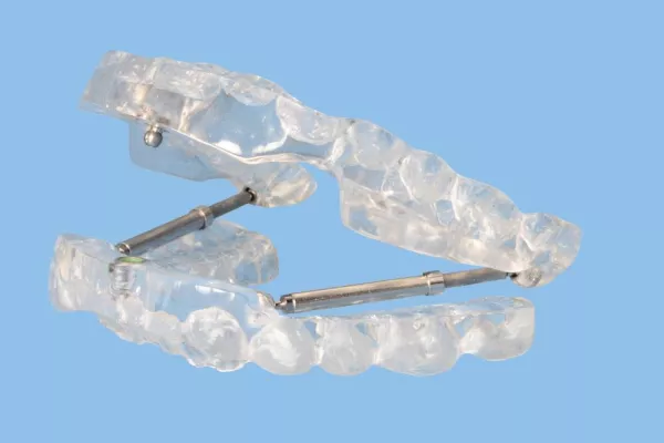 Bild: Schnarchtherapie mit Komfort: Biofunktionelle Therapie und Protrusionsschiene