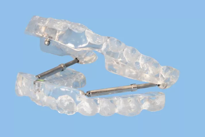 Bild: Schnarchtherapie mit Komfort: Biofunktionelle Therapie und Protrusionsschiene