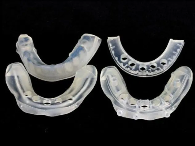 Implantate und Zahnersatz am 3D-gedruckten Modell anpassen Bild: Implantate und Zahnersatz am 3D-gedruckten Modell anpassen