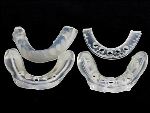 Bild: Implantate und Zahnersatz am 3D-gedruckten Modell anpassen