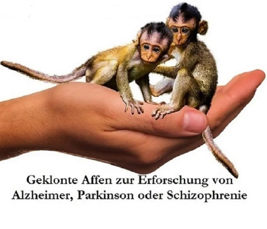 DEMENZ Hirnforschung
