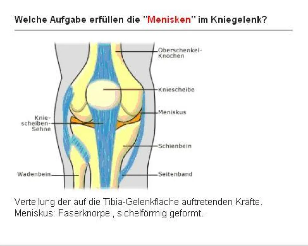In CoboCards erstellte Lernkarte der Medizin