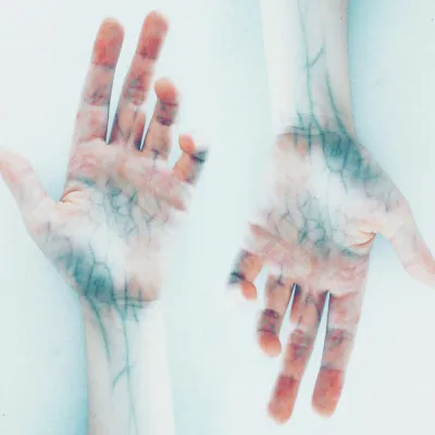 Bild: Dr. med. Bernhard Scheja: Farbdoppler-Sonografie in der internistischen Praxis