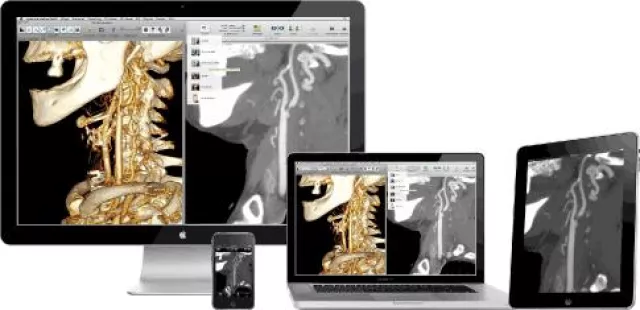 Bild: 91. Deutscher Röntgenkongreß - aycan präsentiert Apples iPad