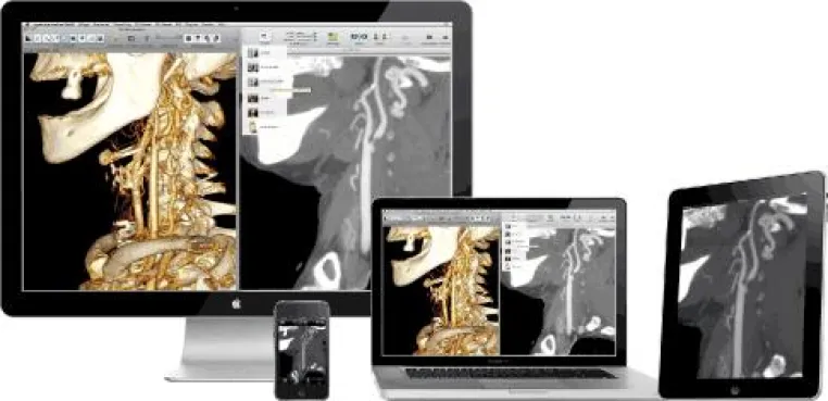 Bild: 91. Deutscher Röntgenkongreß - aycan präsentiert Apples iPad