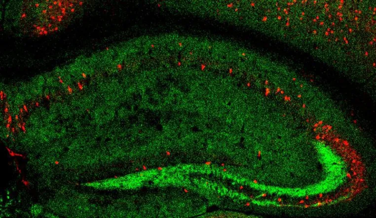 Bild: Warum erhöhen psychiatrische Erkrankungen in jungen Jahren das Demenzrisiko im Alter?