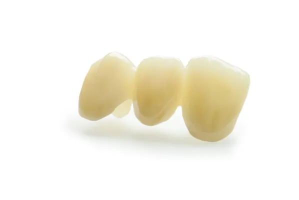 Bild: white präsentiert hochtransluzentes Zirkoniumdioxid für Fräsdienstleistungen