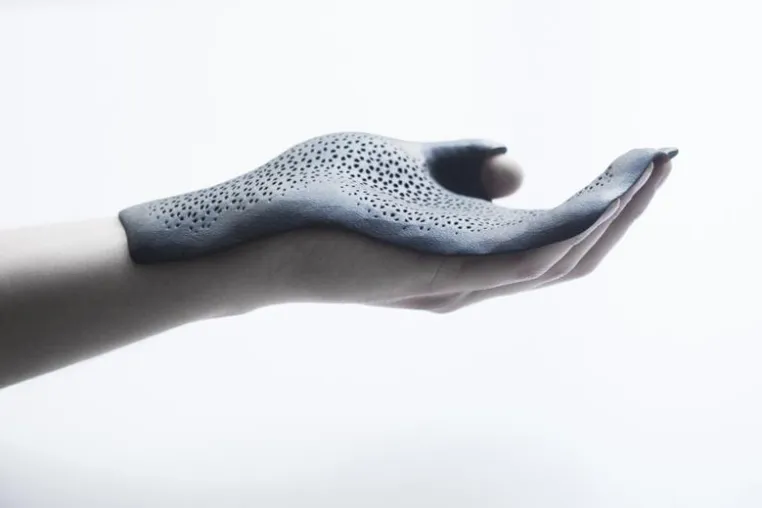 Bild: Die neue Grenze der generativ gefertigten Orthesen: 3D-Druck und Windform® Material