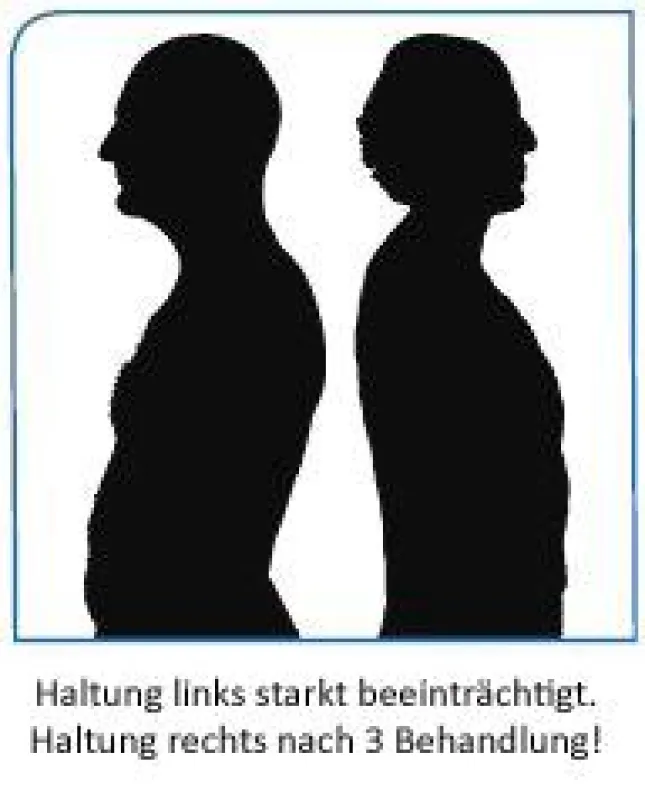 Aufrichtung