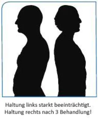Bild: Rückenschmerzen – auch die Psyche kann verantwortlich sein