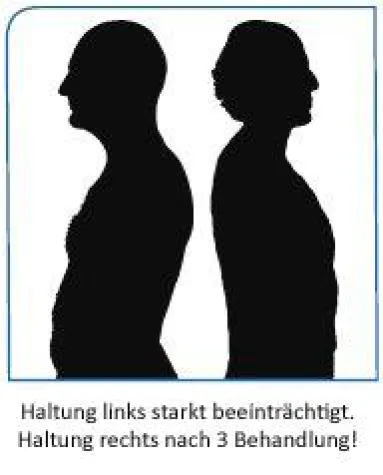 Bild: Rückenschmerzen – auch die Psyche kann verantwortlich sein