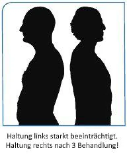 Bild: Rückenschmerzen – auch die Psyche kann verantwortlich sein