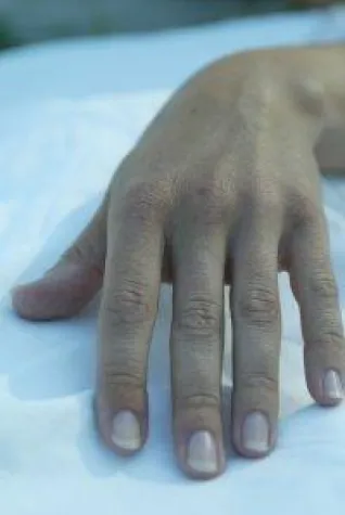 Bild: Biotin, das Schönheitsvitamin