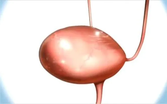 Bild: In „Neues aus der Medizin“ haben die Zuschauer das Thema Blasenkrebs gewählt