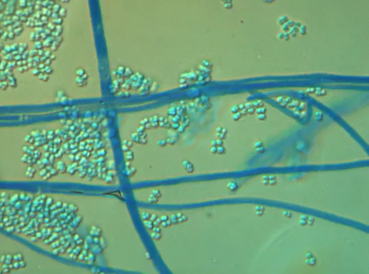 Bild: Dermatophyten und Pilzerkrankungen der Haut