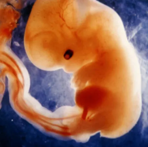 Überraschendes Verbot von pränatalen Diagnosen Bild: Überraschendes Verbot von pränatalen Diagnosen