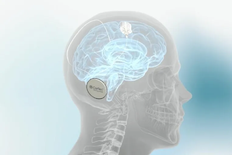 Konsortium erhält 2 Millionen Euro Förderung für neue MR-kompatible elektrophysiologis Bild: Konsortium erhält 2 Millionen Euro Förderung für neue MR-kompatible elektrophysiologis