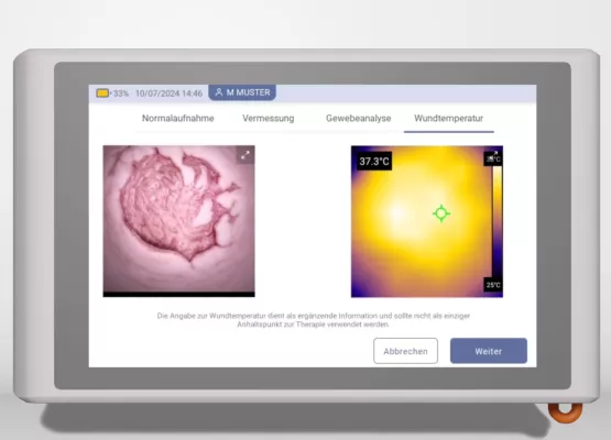 Bild: Innovation für Pflege und Klinik: KI für chronische Wunden erkennt Temperatur, Tiefe und Gewebearten 