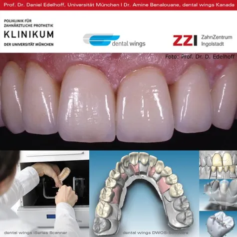 Bild: ZahnZentrum Ingolstadt: Patienten staunen über High End-Materialien und High Tech-Zahnersatz