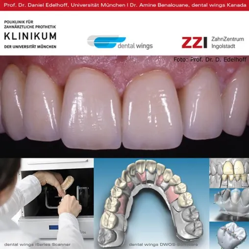 Bild: ZahnZentrum Ingolstadt: Patienten staunen über High End-Materialien und High Tech-Zahnersatz