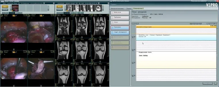 Bild: VEPRO PACS / VIS Lösungen jetzt auch im Ural