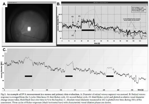 Bild: Retinale Gefäßanalyse erstmals auch an der Maus