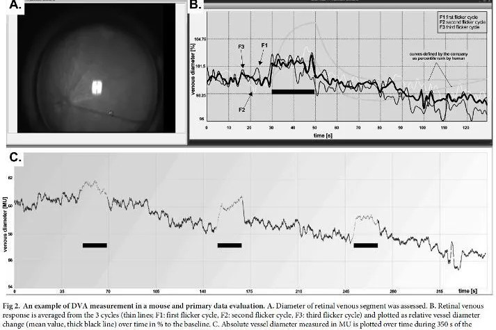 Bild: Retinale Gefäßanalyse erstmals auch an der Maus