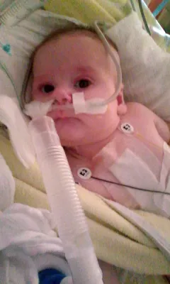 Bild: Baby Kirill – ein Leben am seidenen Faden