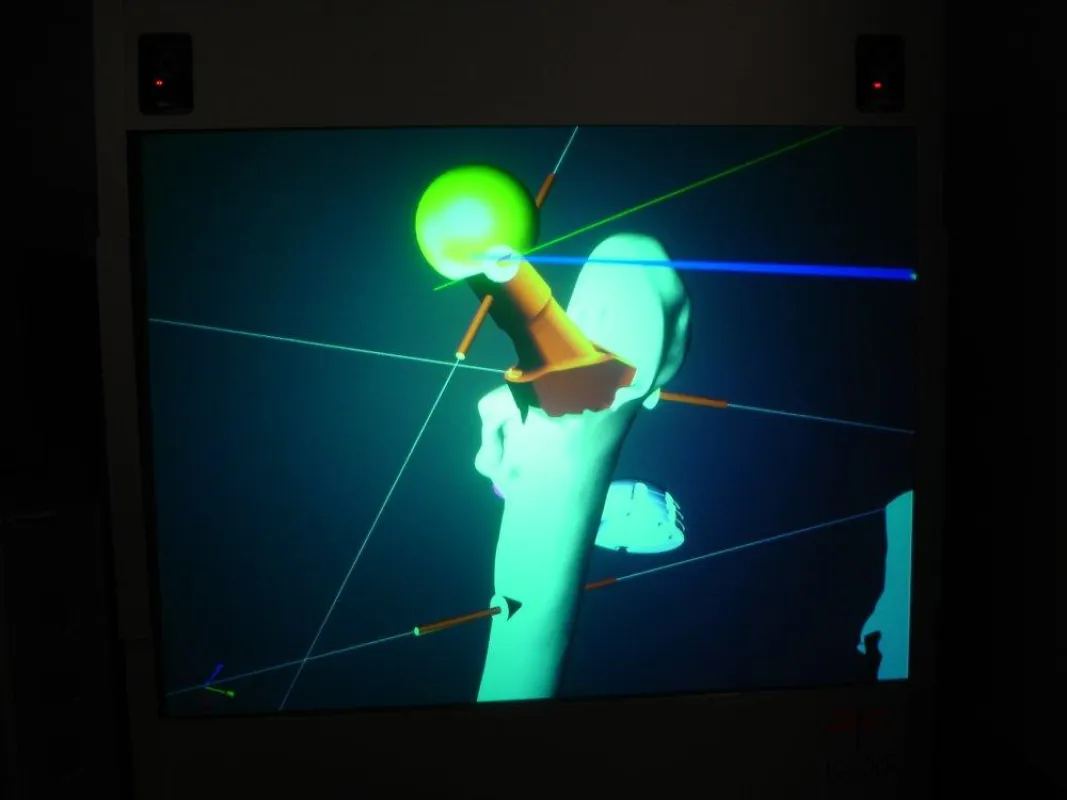 3-D Visualisierung eines Hüftgelenkes in der Virtuellen Realität