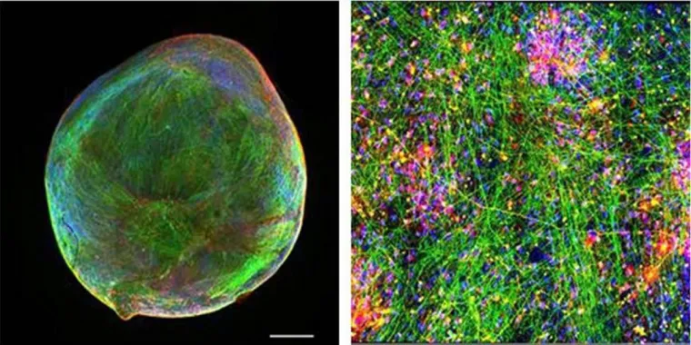 Bild: Bioengineered Neuronal Organoids ab sofort bei myriamed erhältlich