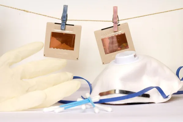 Wie man verschimmelte Dias reinigt - Tipps vom Sanierungsexperten Bild: Wie man verschimmelte Dias reinigt - Tipps vom Sanierungsexperten