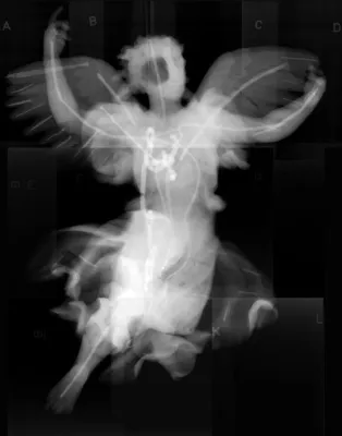 Bild: Zwillingsbilder. Röntgenfotografien von Skulpturen